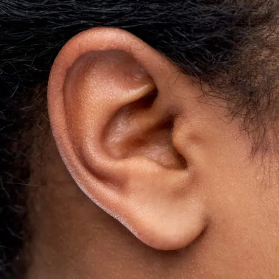 Ear Lobule Repair