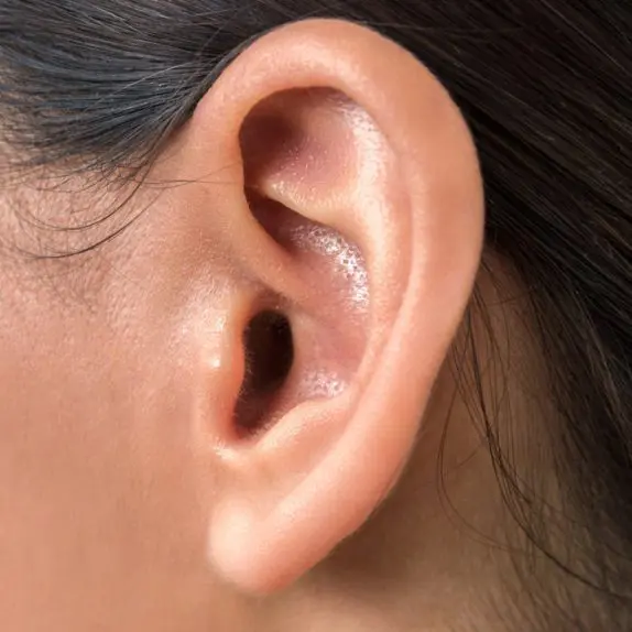 Earlobe Deformities