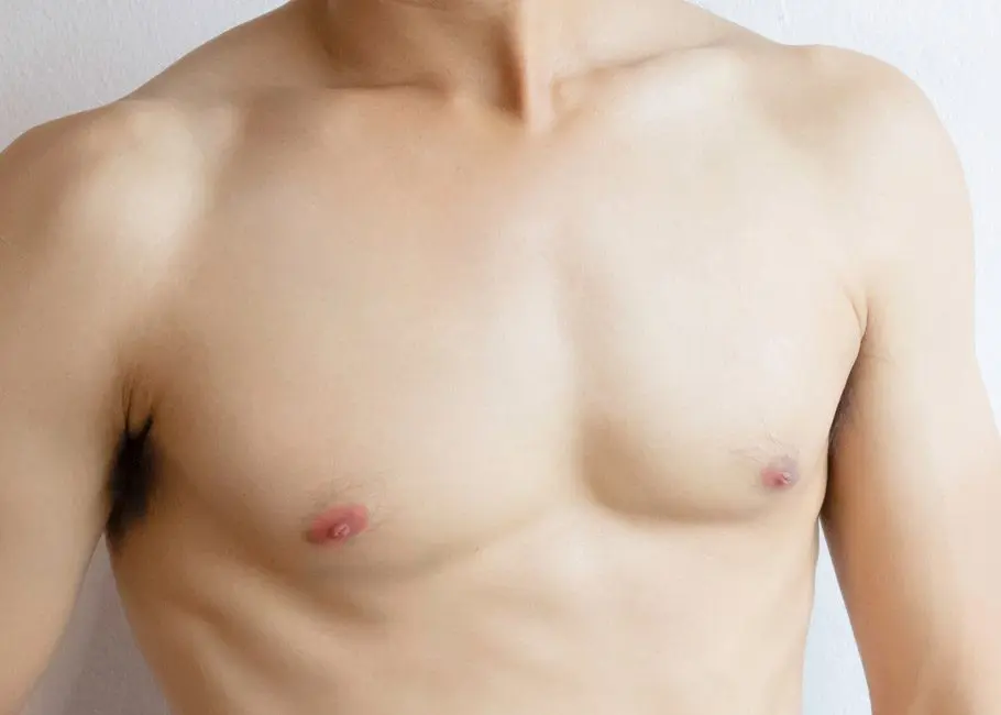 Gynaecomastia Correction