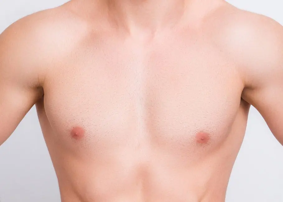 Gynaecomastia