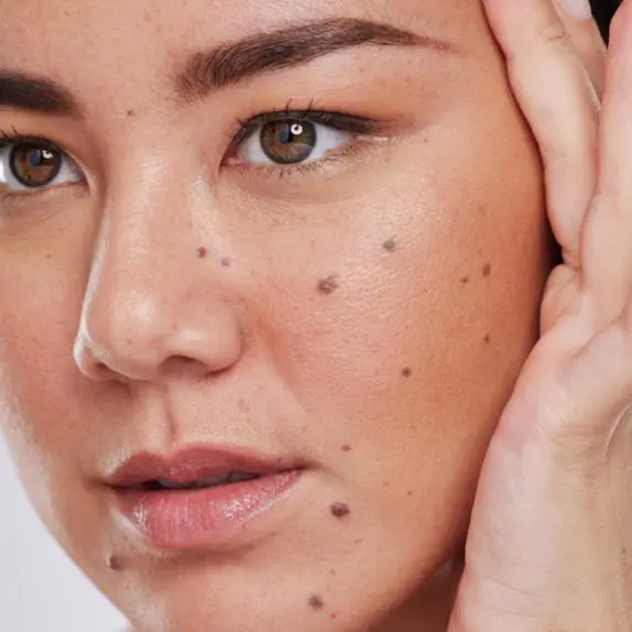 Moles