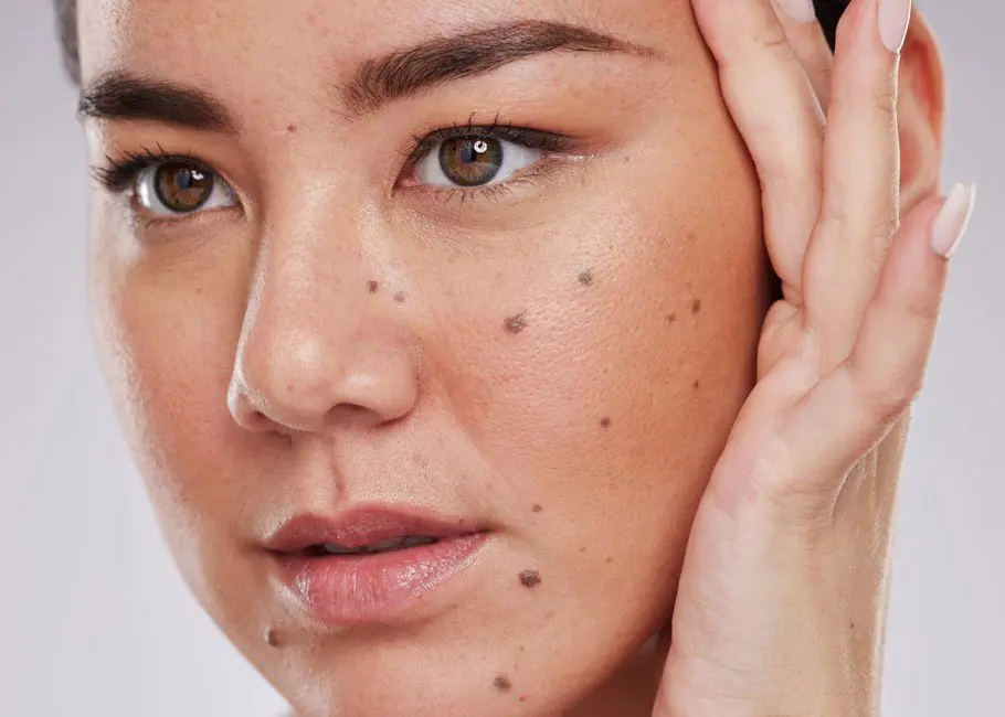 Moles