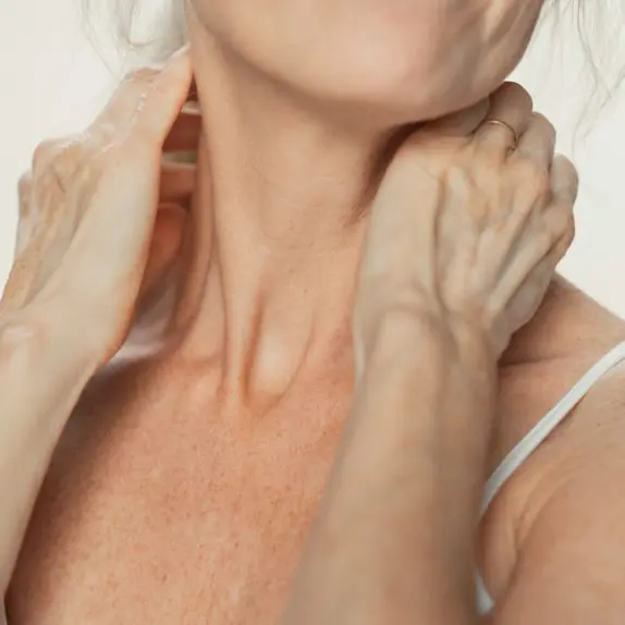 Seborrhoeic Keratosis