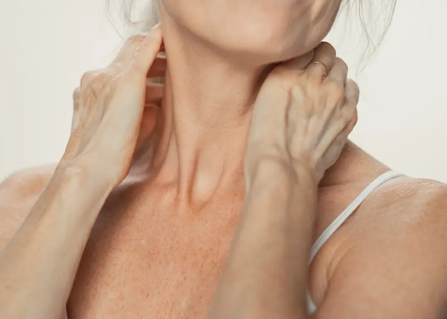 Seborrhoeic Keratosis