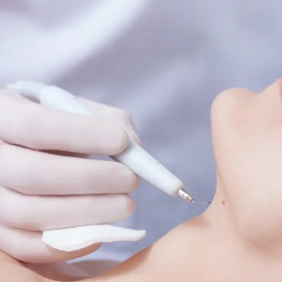 Warts and Verrucae Removal
